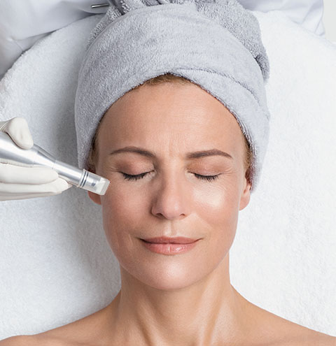 Microneedling im Beauty Spa Munich